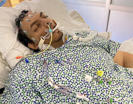 While in the hospital, Marzuk “Ron” Chaudry was on a ventilator for 3-4 weeks.